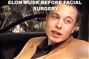 ELON-MUSK-PLASTIC-SURGERY-272x182__ELON_MUSK_IS_A_LIAR_SCAMMER_POLITICAL_BRIBERY_CROOK.png